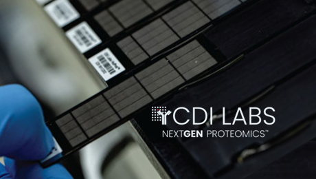 HuProt™ Human Proteome Microarray v4.0 HuProt™ Human Proteome Microarray v4.0