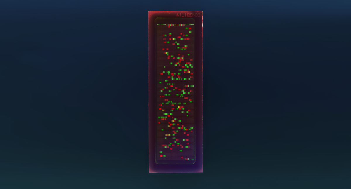 PEPperCHIP® Lupus Microarray